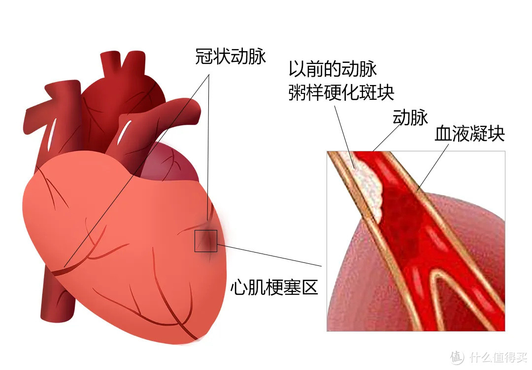 这种病死亡率比癌症还高，保险怎么赔？