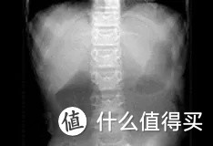 中国人的肺为什么那么脆弱？