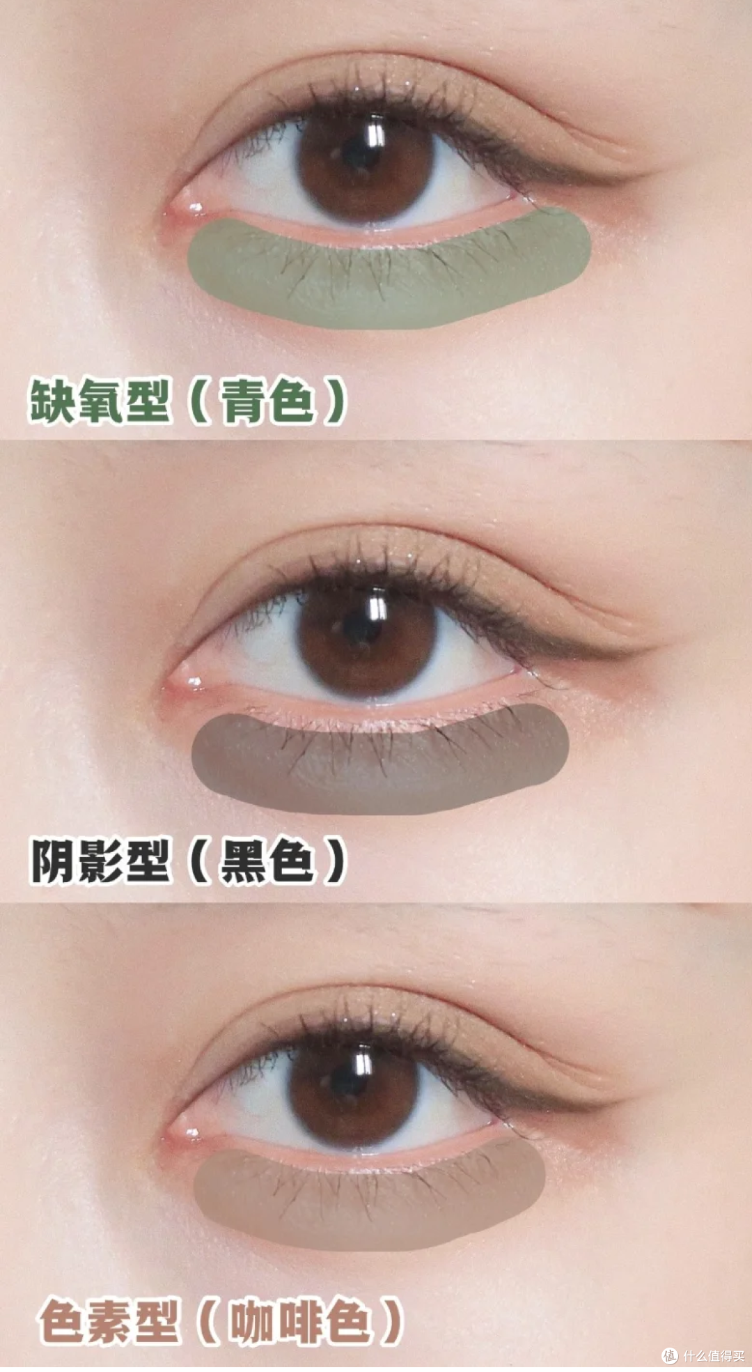 黑眼圈是否会拉低颜值
