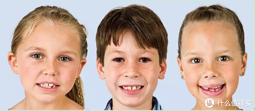 7成以上的孩子有不同程度的错颌畸形  18个儿童正畸问题详解，别错过牙齿矫正黄金期
