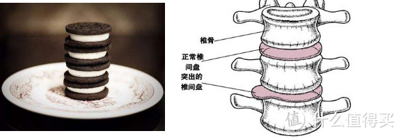 你的腰还好吗？腰椎间盘最突出还能买保险吗？