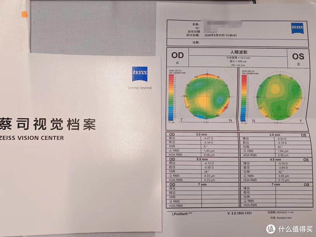 小蓝盾的信仰之蔡司智锐初体验