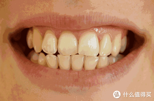 牙齿美白方式那么多，选择技巧看这里！