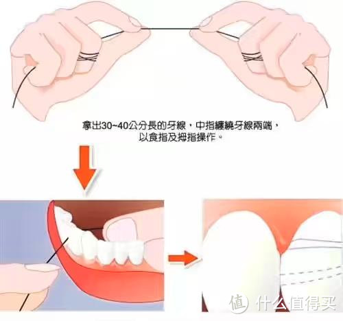 牙线圈使用手法很重要，否则容易损伤牙龈。