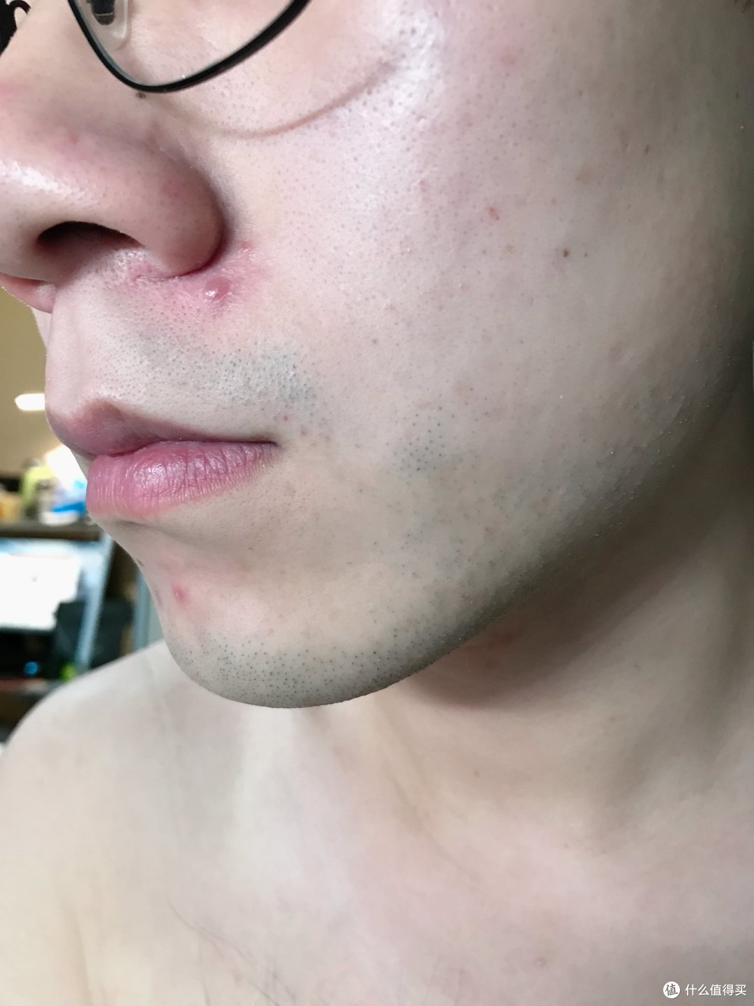 男人用激光脱毛仪脱胡子到底有没有效果?