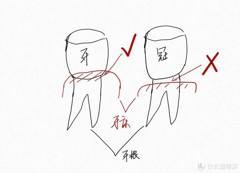 我经历过的牙科治疗：龋齿、拔牙、立事牙、根管治疗、烤瓷牙、儿童牙齿损伤