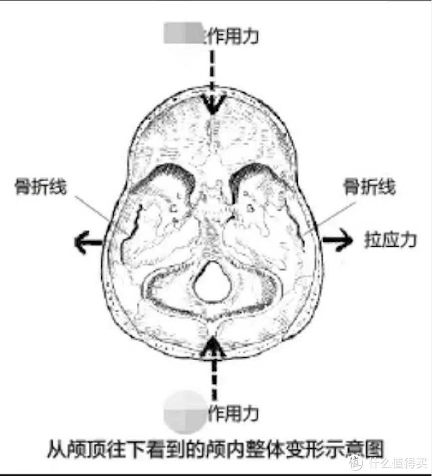 阅尸无数，侦破命案上千，23年法医工作经历，就他在科普死亡那些事！