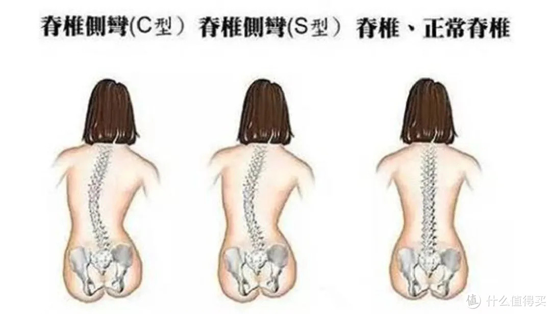 每天跷二郎腿的人，都是这个下场......看完赶紧坐直了