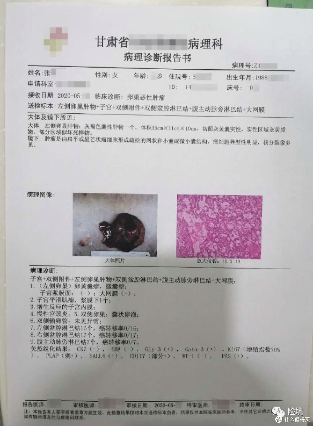 理赔案例丨28岁女孩罹患肺癌,重疾顺利获赔50万