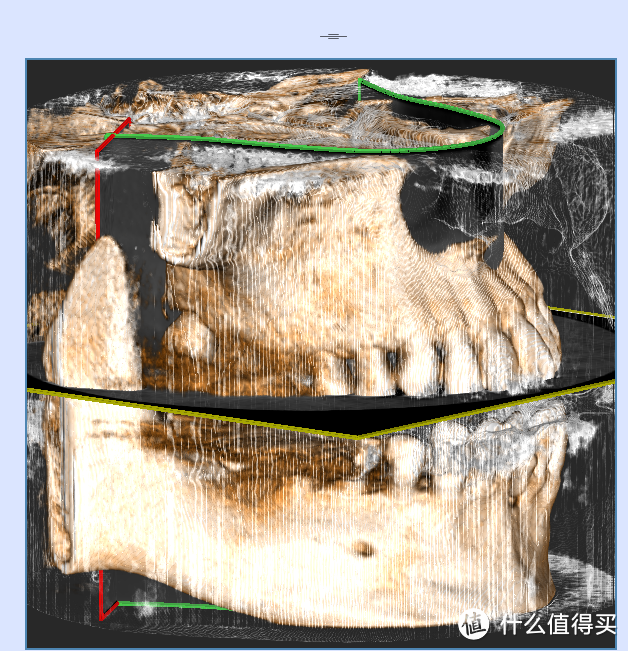 除了益达还有联想声波电动牙刷T1——关爱牙齿更关心你