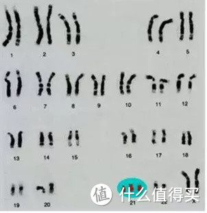 快速弄懂：唐筛 vs 无创DNA vs 羊水穿刺