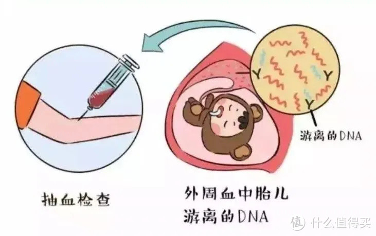 快速弄懂：唐筛 vs 无创DNA vs 羊水穿刺