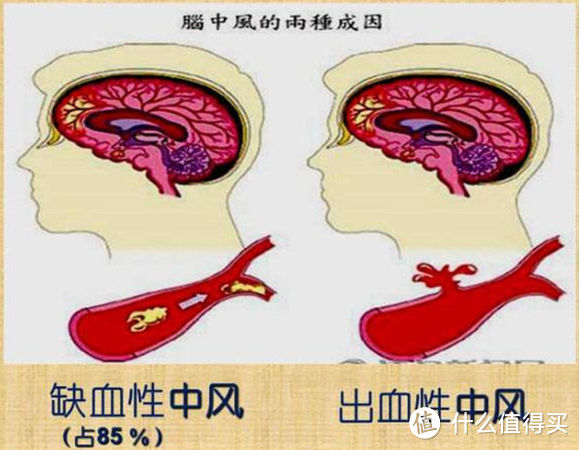 这几种常见老年病你身边一定有人得过，如何照顾他们，你真的清楚吗？