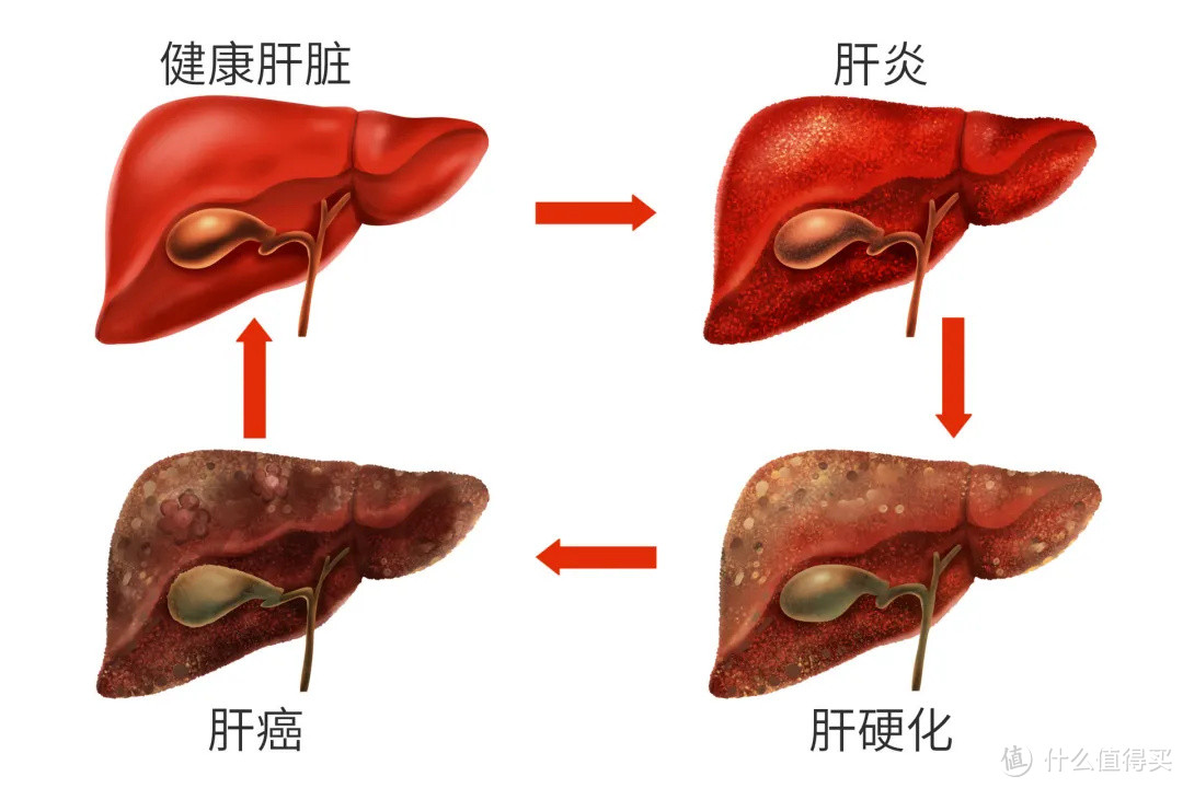 爷青结！「达叔」去世，肝癌为何一发现就是晚期？