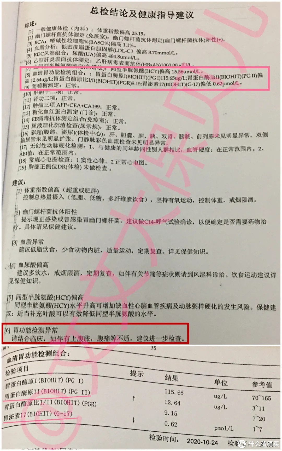 核保实例:胃蛋白酶原、胃泌素17异常,重疾险标准体承保