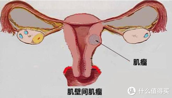 卵巢早衰的症状及危害有哪些又该怎么办？吃什么告诉你！