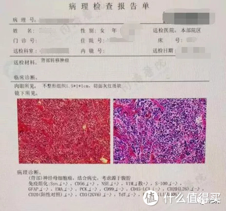 理赔案例丨孩子缺钱治病，妈咪保贝提前赔付50万