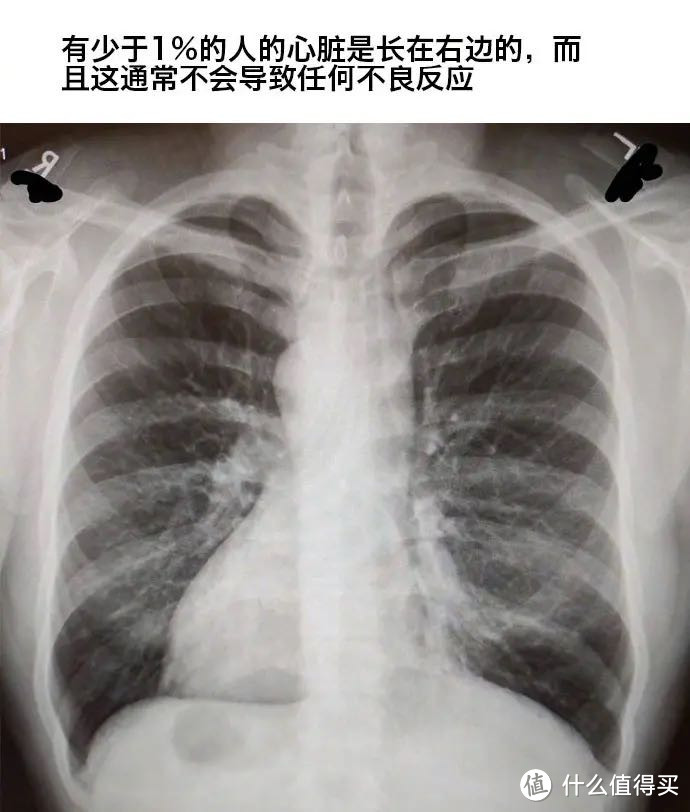 你知道自己身上有哪些“天赋异禀”的地方吗？来看看你是不是那个天选之人吧