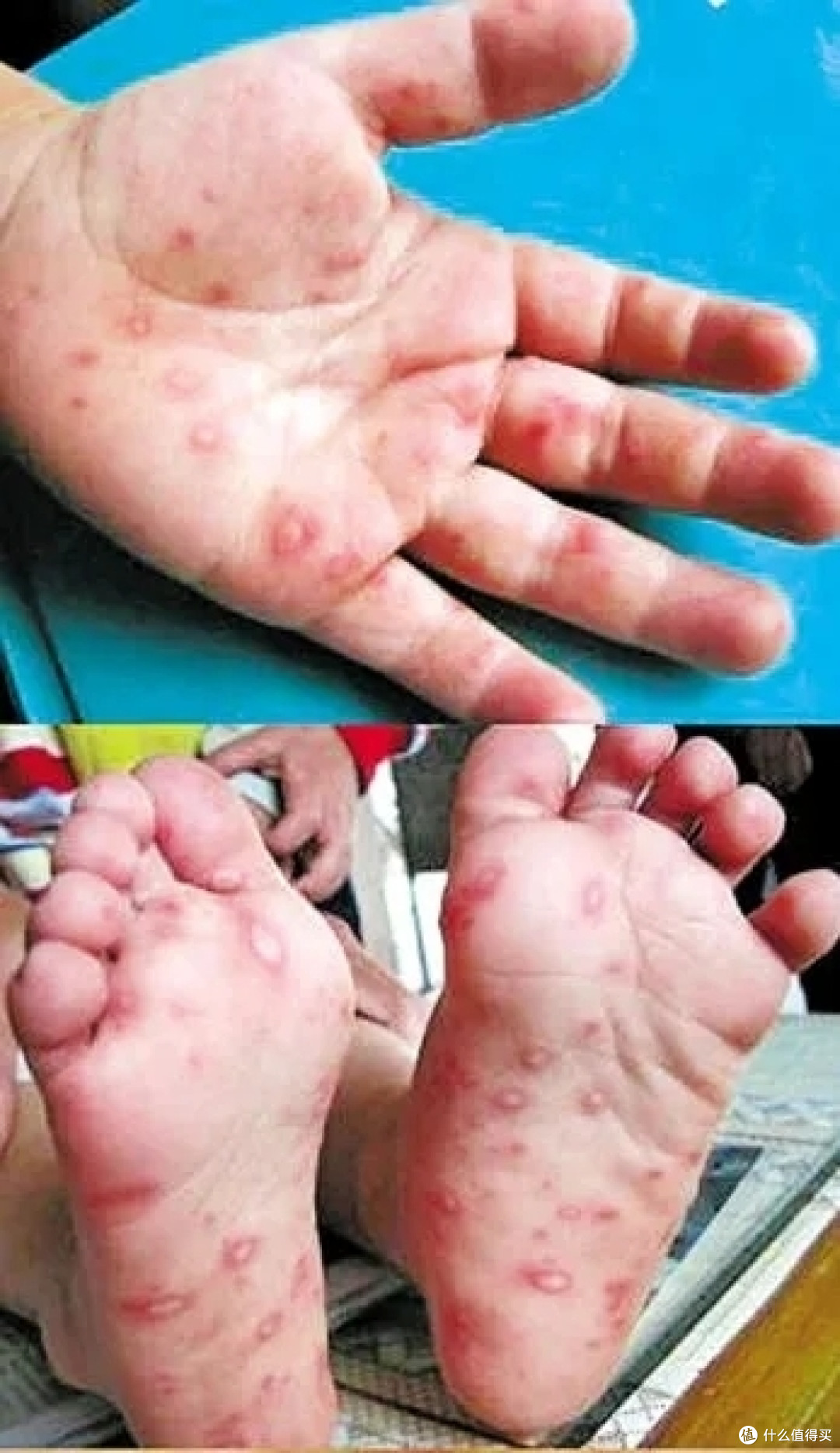 新冠疫情近期有所反弹但是对于小朋友们来说这种病毒更应注意