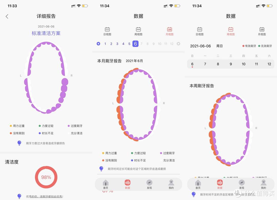 智能口腔护理小能手——欧可林XPro电动牙刷分享