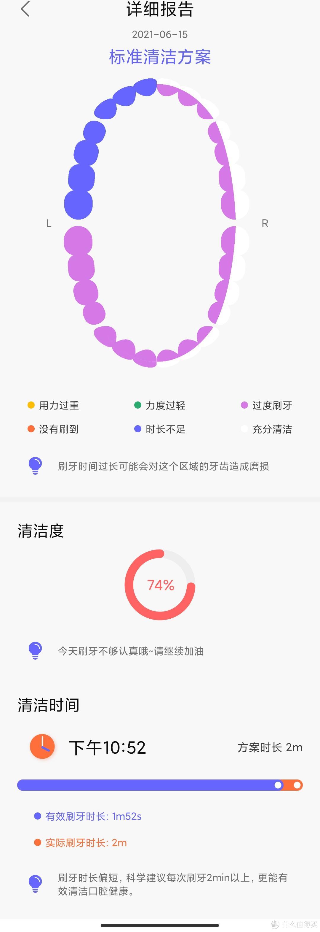 软硬结合刷牙更净——Oclean X Pro旗舰版声波电动牙刷