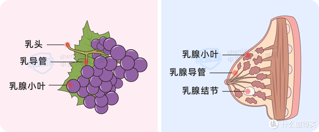 查出了乳腺结节，还能买保险吗？哪款产品理赔最宽松？