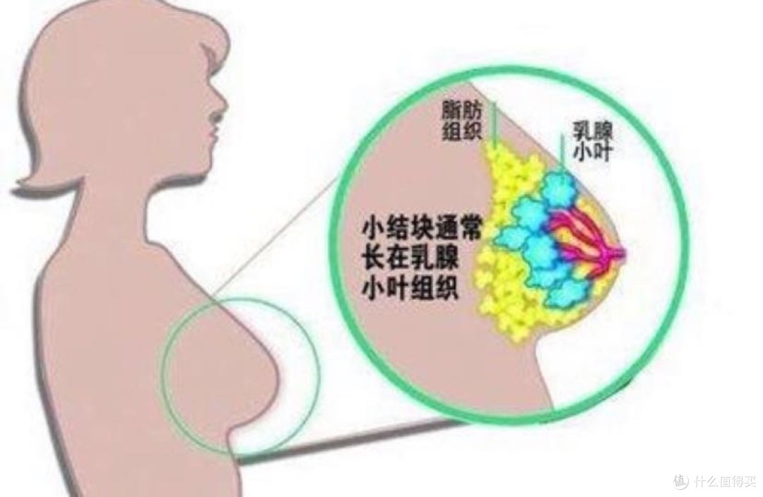 乳腺结节，怎么买保险？