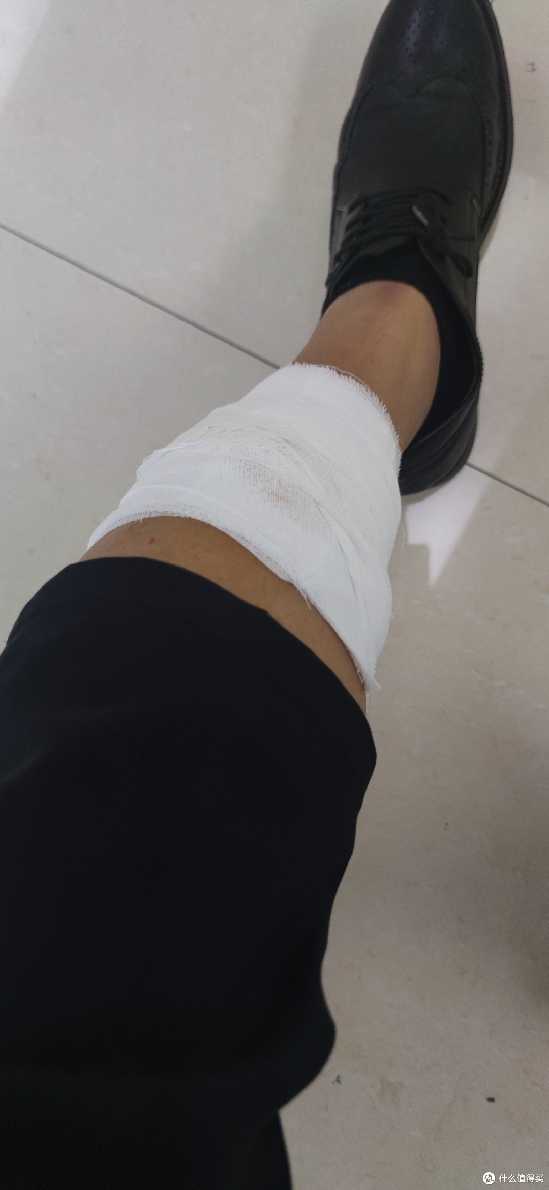 也受过类似的伤就没多在意,其实当时老婆电话里是让我去医院处理的