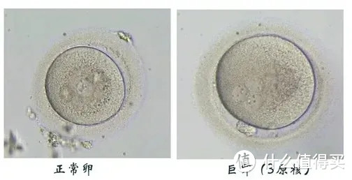 卵泡也看颜值？那究竟最美卵子都长什么样呢
