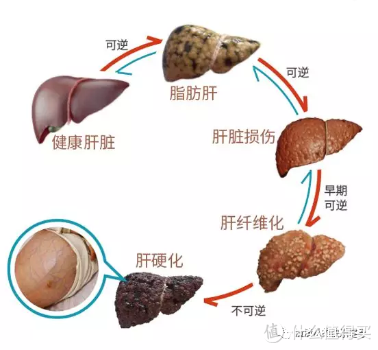 两步改善「脂肪肝」，简单易懂好上手的实操干货来啦～