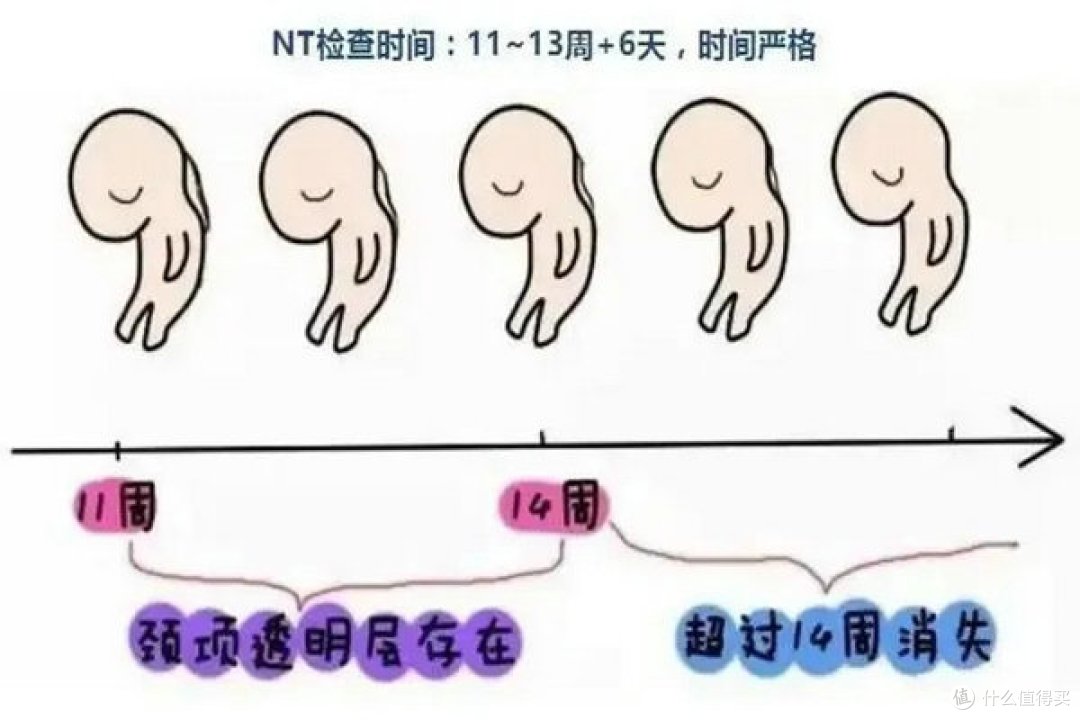 NT检查在试管婴儿中的作用是什么?一文破解NT检查的秘密