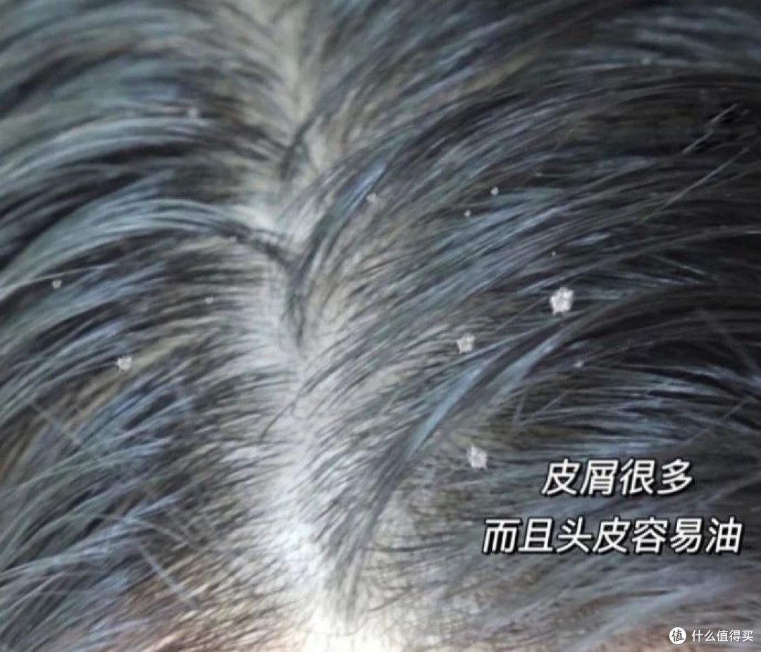 洗发水大合集，防脱、控油、去屑洗发水真实分享！