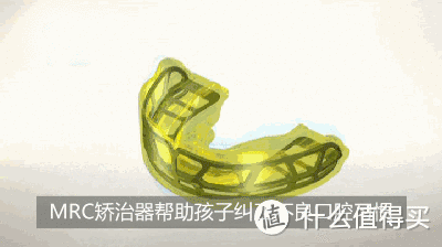 小孩子牙齿不齐没关系也不用整?那你就错啦,两大“整牙神器”了解一下