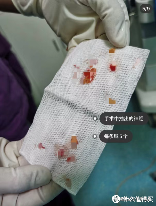 消除肌肉腿?「小腿肌肉阻断术」无异于自残!