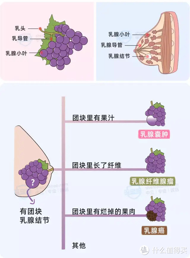 乳腺结节会癌变吗？10个女性中8个有，越早买保险越好