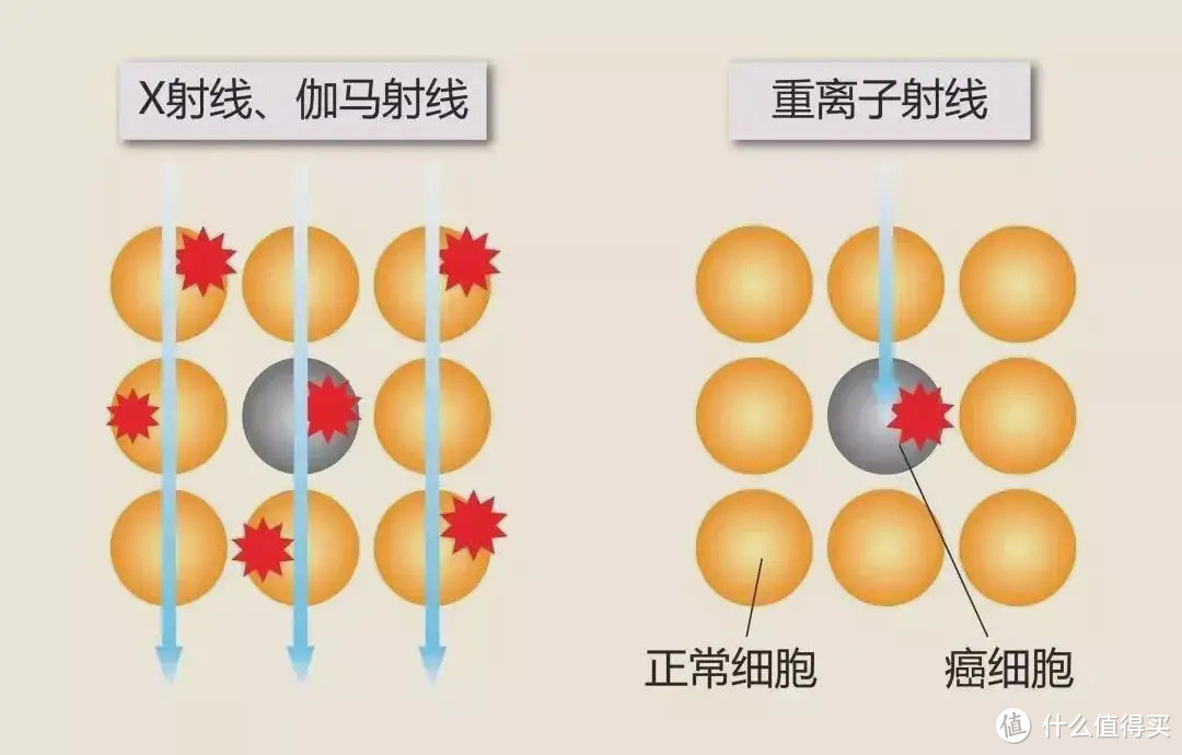 建议收藏！不同年龄癌症筛查干货，以及先进癌症治疗方法，告诉你哪些防癌保险更到位