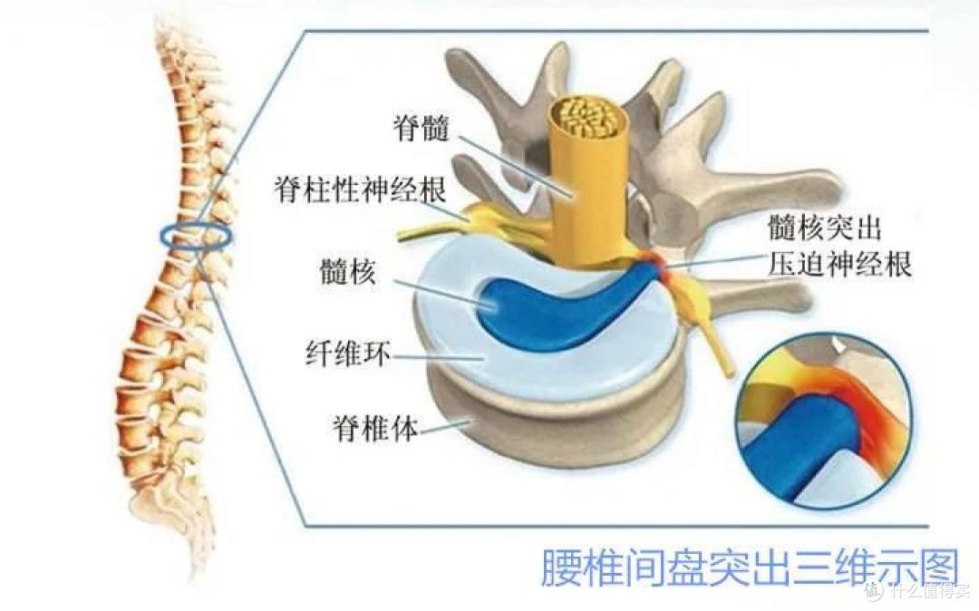 拯救腰间盘,从换椅子开始!!