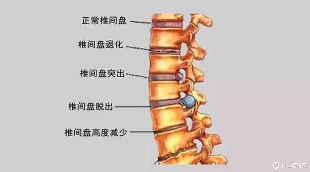 拯救腰间盘,从换椅子开始!!