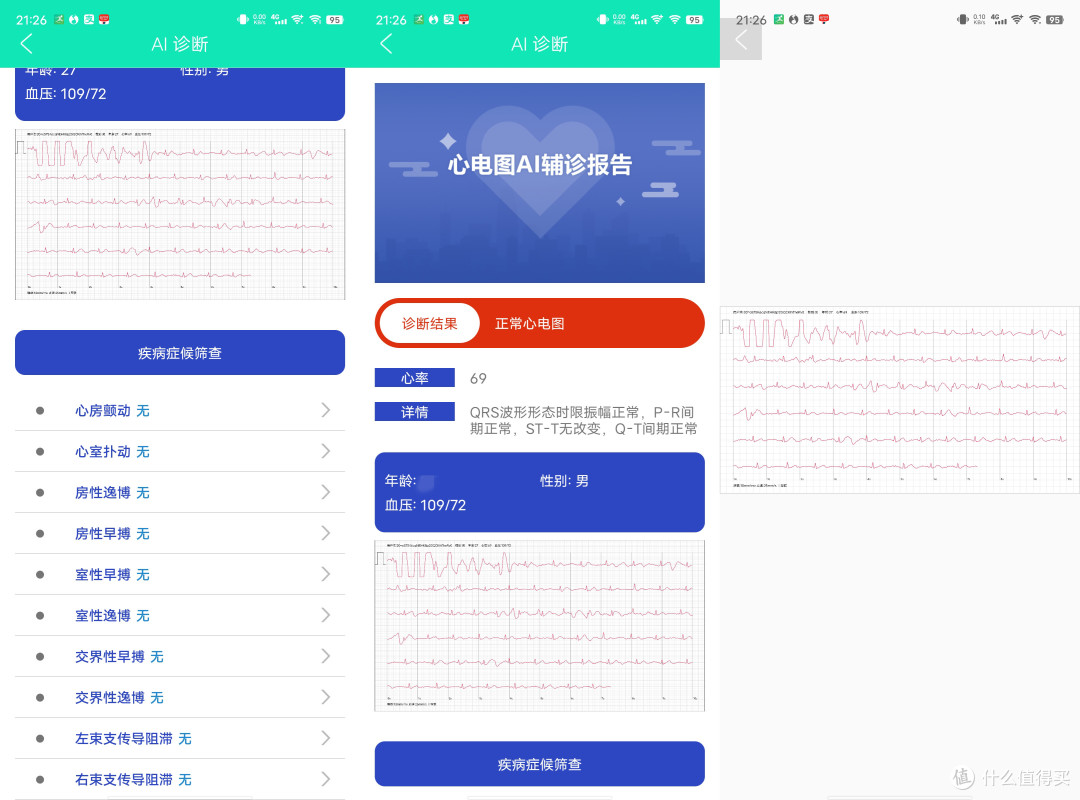 didoE10血压心电智能手表—手腕上的健康管家
