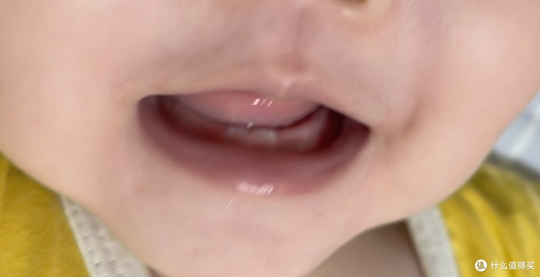 从乳牙到恒牙，一文说清宝宝牙齿常见的几大问题