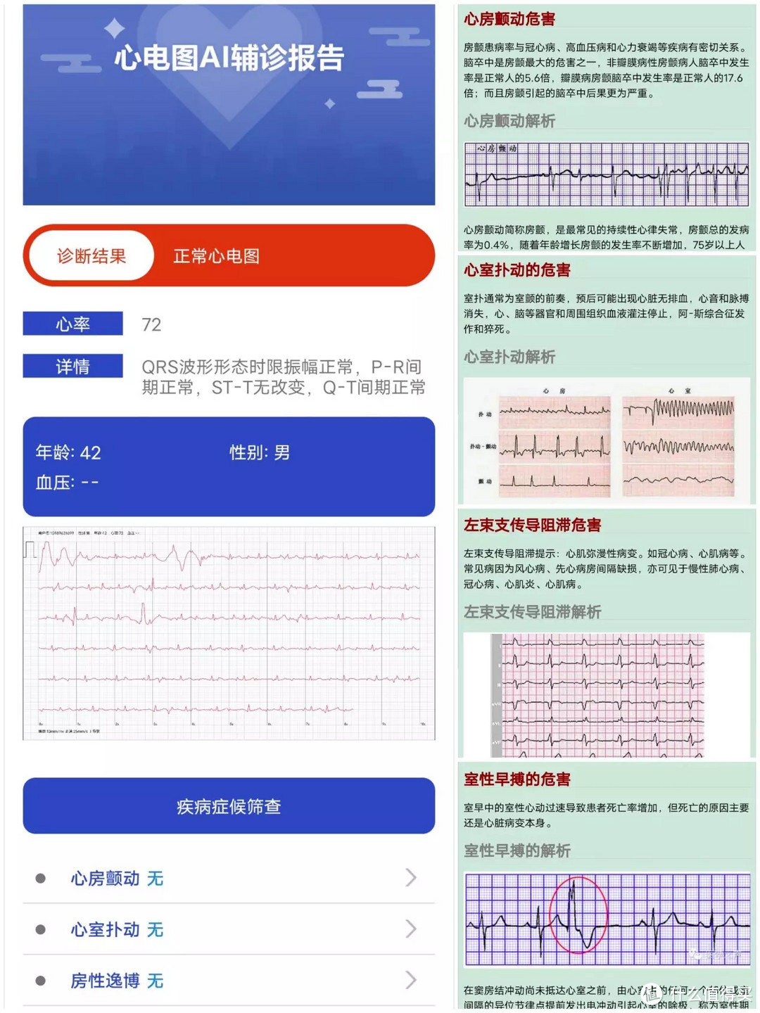 智能手表居然能测心电图？ Dido E10健康监测智能手表评测