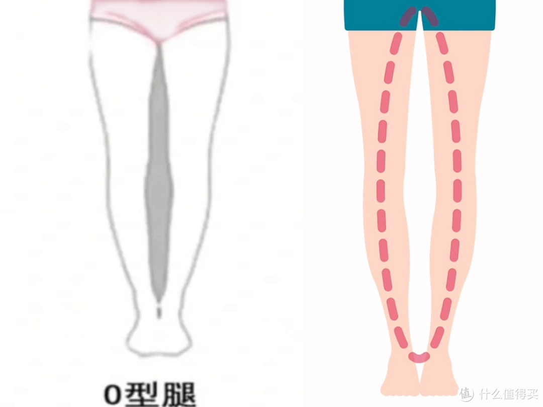 XO型腿、X型腿与O型腿的解决方案顺便教你如何瘦腿，保姆级教程快来练！
