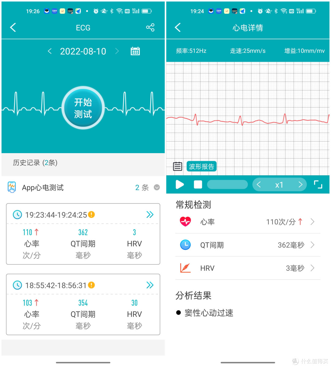 80后养生新科技:dido G28S PRO心电血压智能手表体验