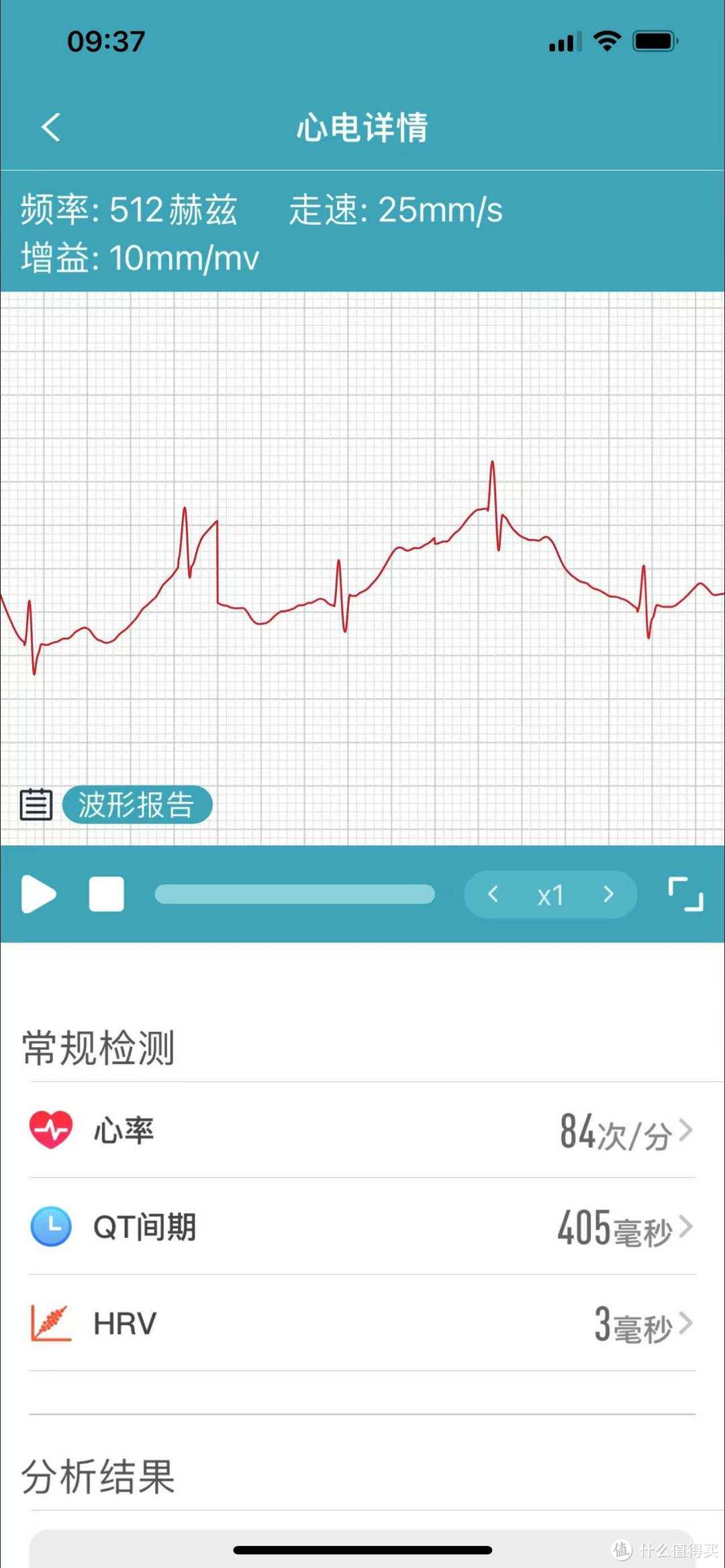 80、90后的健康新风向-dido G28S血压心电智能手表