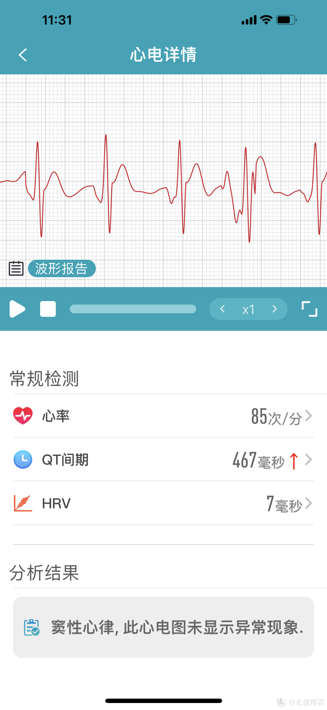 运动、健康状况数据化更可信、更有趣：体验dido Y1S高精密测血压手环