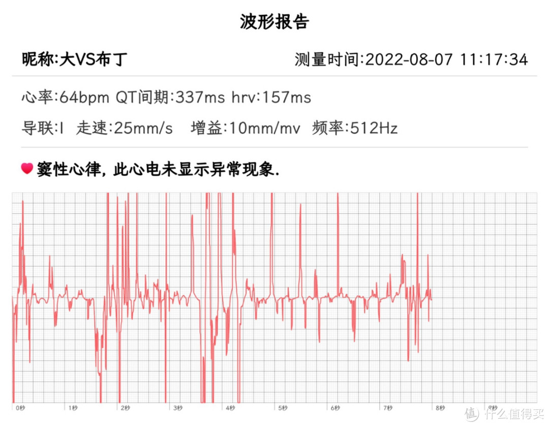 升级闪耀全面屏，全天健康监测：dido G28S智能手表评测！