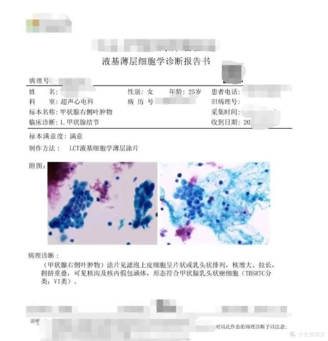 保险获赔54万!25岁女孩做对2件事!