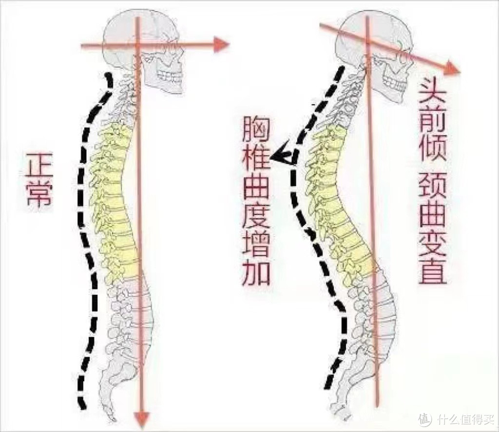 月销过万的网红十字棍，真的能纠正驼背？用了三个月，谈谈感受