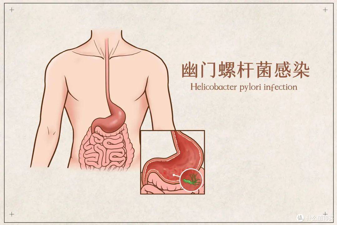 你的胃病,竟然不是吃出来的?!