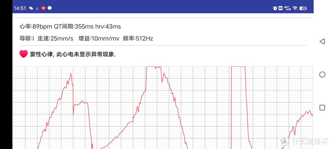 高性价比国产好手表：能测心电的智能手表，dido G28S Pro上手